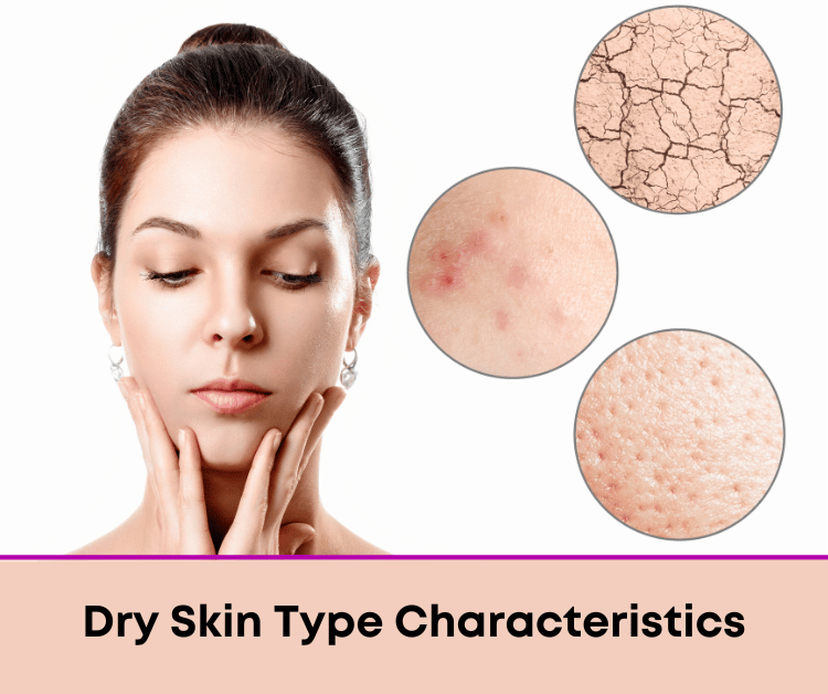Woman with Dry Skin Type Characteristics
